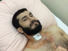 Mamed Khalidov przeszedł operację kręgosłupa