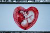Na ulicach Olsztyna pojawiły się antyaborcyjne plakaty