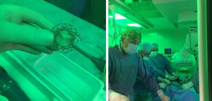 Artykuł: Pionierska operacja kardiologiczna w Szpitalu Wojewódzkim w Olsztynie