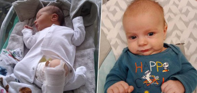 2-miesięczny Jaś z Olsztyna urodził się z chorobą kości. Potrzebne środki na leczenie