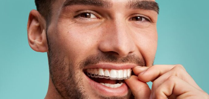 Szukasz przystępnego cenowo aparatu na zęby? Postaw na nakładki clear aligner