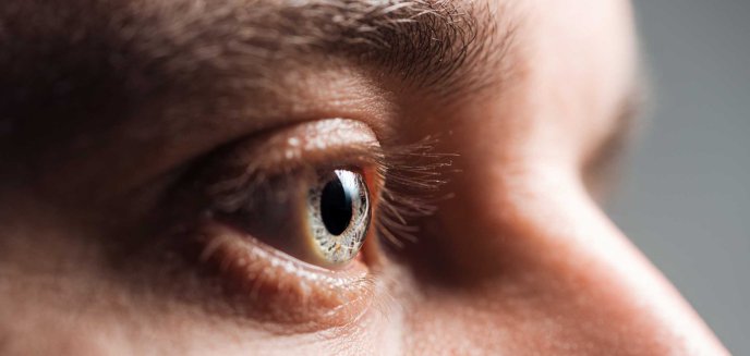 Nużyca oczu – jakie daje objawy i jak walczyć z zakażeniem?