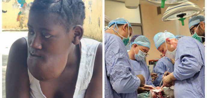 15-letnia Cristina z Angoli zbiera na rekonstrukcję uzębienia. Lekarze z Olsztyna zrzekną się honorarium