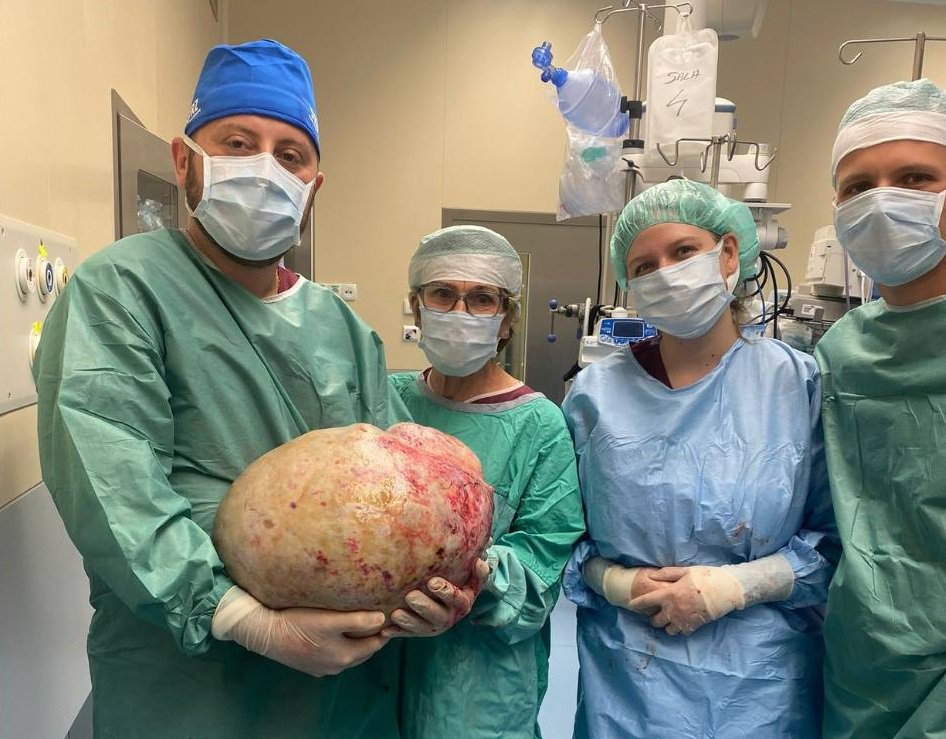 Elbląg. 68-latka nosiła w brzuchu guza ważącego 20 kg