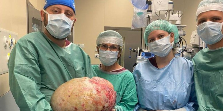 Elbląg. 68-latka nosiła w brzuchu guza ważącego 20 kg