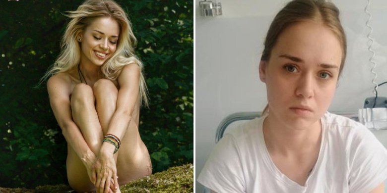 „Moje ciało nie współpracuje”. Fotomodelka z Olsztyna cudem uniknęła śmierci. Angelika Kaza walczy o każdy krok i apeluje o pomoc