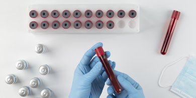 Artykuł: Jak odczytywać wyniki morfologii krwi? Co oznaczają poszczególne skróty?