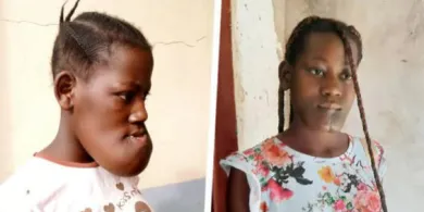 Olsztyńscy lekarze ponownie pomogą 17-letniej Cristinie z Angoli. Trwa zbiórka środków