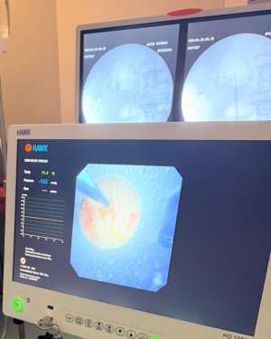 Pierwsze takie zabiegi na Warmii i Mazurach. Ostródzki szpital rozwija urologię